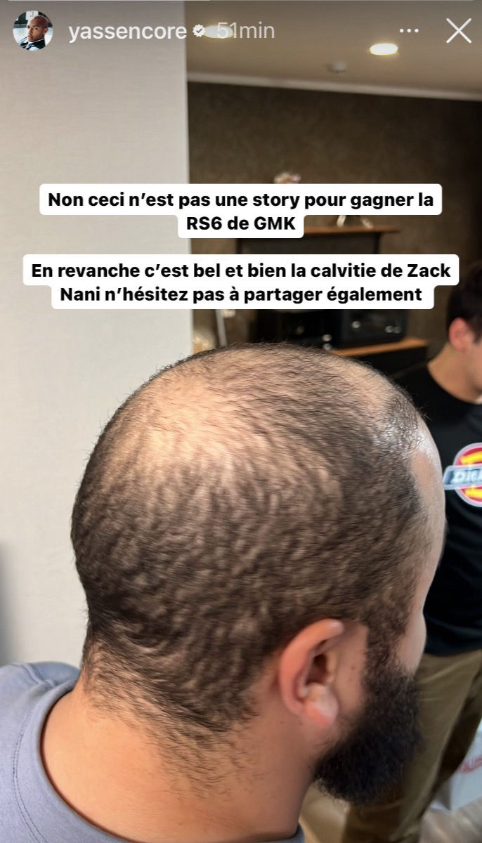 yassencore rigole de la calvitie de zack nani